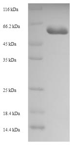 Recombinant Human Carboxypeptidase A6(CPA6)