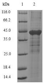 Recombinant Human Carcinoembryonic antigen-related cell adhesion molecule 1(CEACAM1),partial