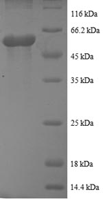 Recombinant Human Casein kinase I isoform epsilon(CSNK1E),partial
