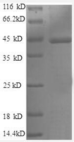 Recombinant Human Caspase-1(CASP1),partial