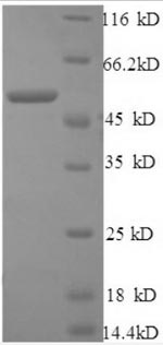 Recombinant Human Cathepsin B(CTSB),partial