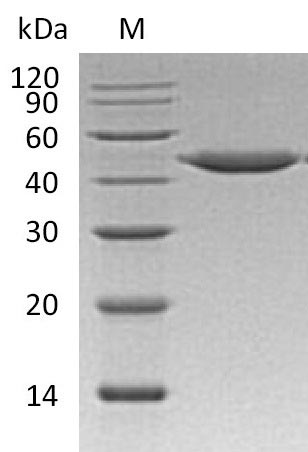 Recombinant Human Cathepsin E(CTSE) (Active)