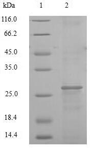 Recombinant Human Cathepsin K(CTSK)