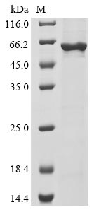 Recombinant Human Cell division cycle protein 20 homolog(CDC20)