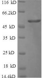 Recombinant Human Cerebellar degeneration-related protein 2(CDR2)