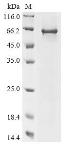 Recombinant Human Charged multivesicular body protein 7(CHMP7)