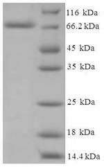 Recombinant Human Cholesterol side-chain cleavage enzyme, mitochondrial(CYP11A1)