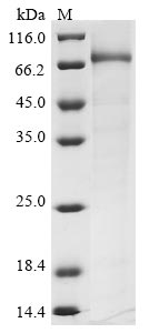 Recombinant Human Choline O-acetyltransferase(CHAT),Partial