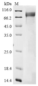 Recombinant Human Choline O-acetyltransferase(CHAT),Partial