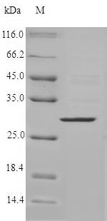 Recombinant Human Chymase(CMA1)
