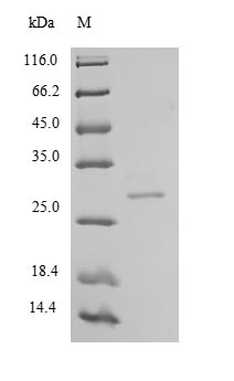 Recombinant Human Chymotrypsin-like elastase family member 2A(CELA2A)