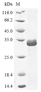 Recombinant Human Chymotrypsin-like elastase family member 3B(CELA3B)