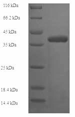 Recombinant Human Collagen alpha-1(IV) chain(COL4A1) ,partial