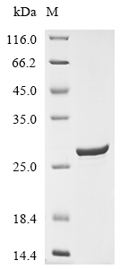 Recombinant Human Collagen alpha-1(XV) chain(COL15A1),partial
