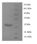 Recombinant Human Collagen alpha-1(XVII) chain(COL17A1),partial