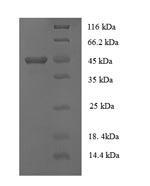 Recombinant Human Collagen alpha-1(XVIII) chain(COL18A1),partial