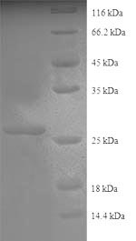 Recombinant Human Collagen alpha-2(IV) chain(COL4A2),partial