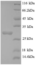 Recombinant Human Collagen alpha-3(IV) chain(COL4A3),partial