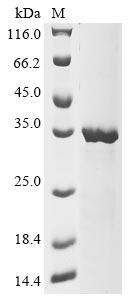 Recombinant Human Collagen triple helix repeat-containing protein 1(CTHRC1)