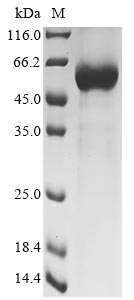 Recombinant Human Collagen triple helix repeat-containing protein 1(CTHRC1),partial