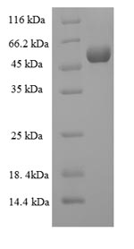Recombinant Human Collagenase 3(MMP13)