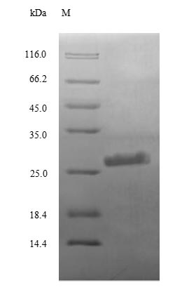 Recombinant Human Complement C3(C3),partial