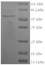 Recombinant Human Complement C4-B(C4B)，partial