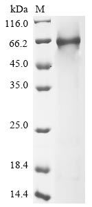 Recombinant Human Complement component C8 alpha chain(C8A),Partial