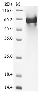 Recombinant Human Complement component C8 beta chain(C8B)