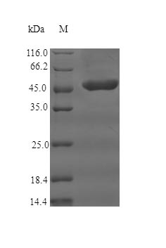 Recombinant Human Complement receptor type 1(CR1),partial