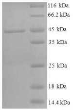 Recombinant Human Corticosteroid 11-beta-dehydrogenase isozyme 1(HSD11B1),partial
