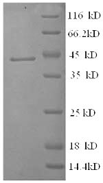 Recombinant Human Corticosteroid-binding globulin(SERPINA6)