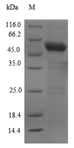 Recombinant Human Cyclic GMP-AMP synthase(CGAS),partial