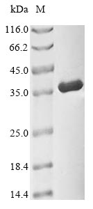 Recombinant Human Cyclin-dependent kinase 1(CDK1)