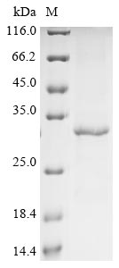 Recombinant Human Cyclin-dependent kinase 5(CDK5)