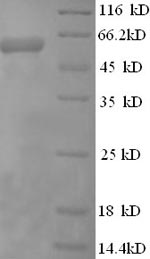Recombinant Human Cystathionine beta-synthase(CBS),partial