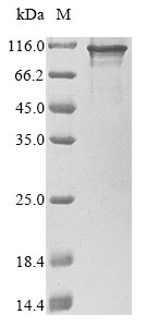 Recombinant Human Cysteine-rich protein 2-binding protein(KAT14)