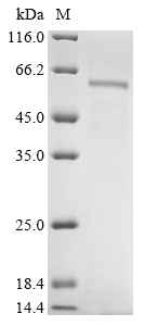 Recombinant Human Cytochrome P450 1A1(CYP1A1)
