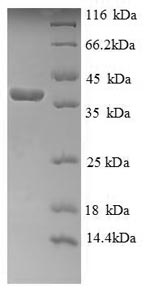 Recombinant Human Cytochrome c(CYCS)