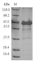 Recombinant Human Cytosolic beta-glucosidase(GBA3)