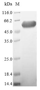 Recombinant Human Cytosolic endo-beta-N-acetylglucosaminidase(ENGASE)