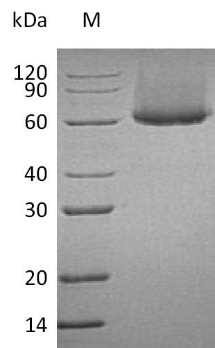 Recombinant Human Cytotoxic and regulatory T-cell molecule(CRTAM),partial (Active)
