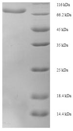 Recombinant Human D-2-hydroxyglutarate dehydrogenase, mitochondrial(D2HGDH)