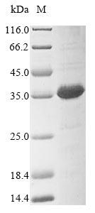 Recombinant Human DDB1- and CUL4-associated factor 16(DCAF16)