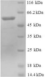 Recombinant Human DDB1- and CUL4-associated factor 7(DCAF7)