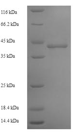 Recombinant Human DNA-directed RNA polymerase III subunit RPC1(POLR3A),partial
