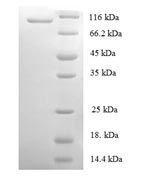 Recombinant Human DNA replication licensing factor MCM2(MCM2) 