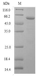 Recombinant Human Deoxyribonuclease gamma(DNASE1L3)