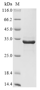 Recombinant Human Deoxyribonuclease gamma(DNASE1L3)