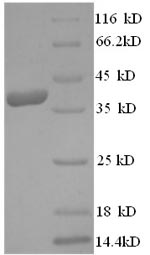 Recombinant Human Dermcidin(DCD)